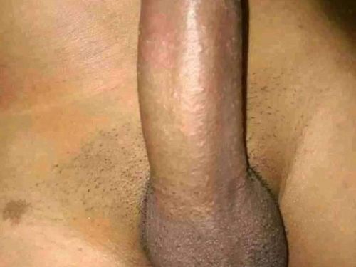 Jorluis